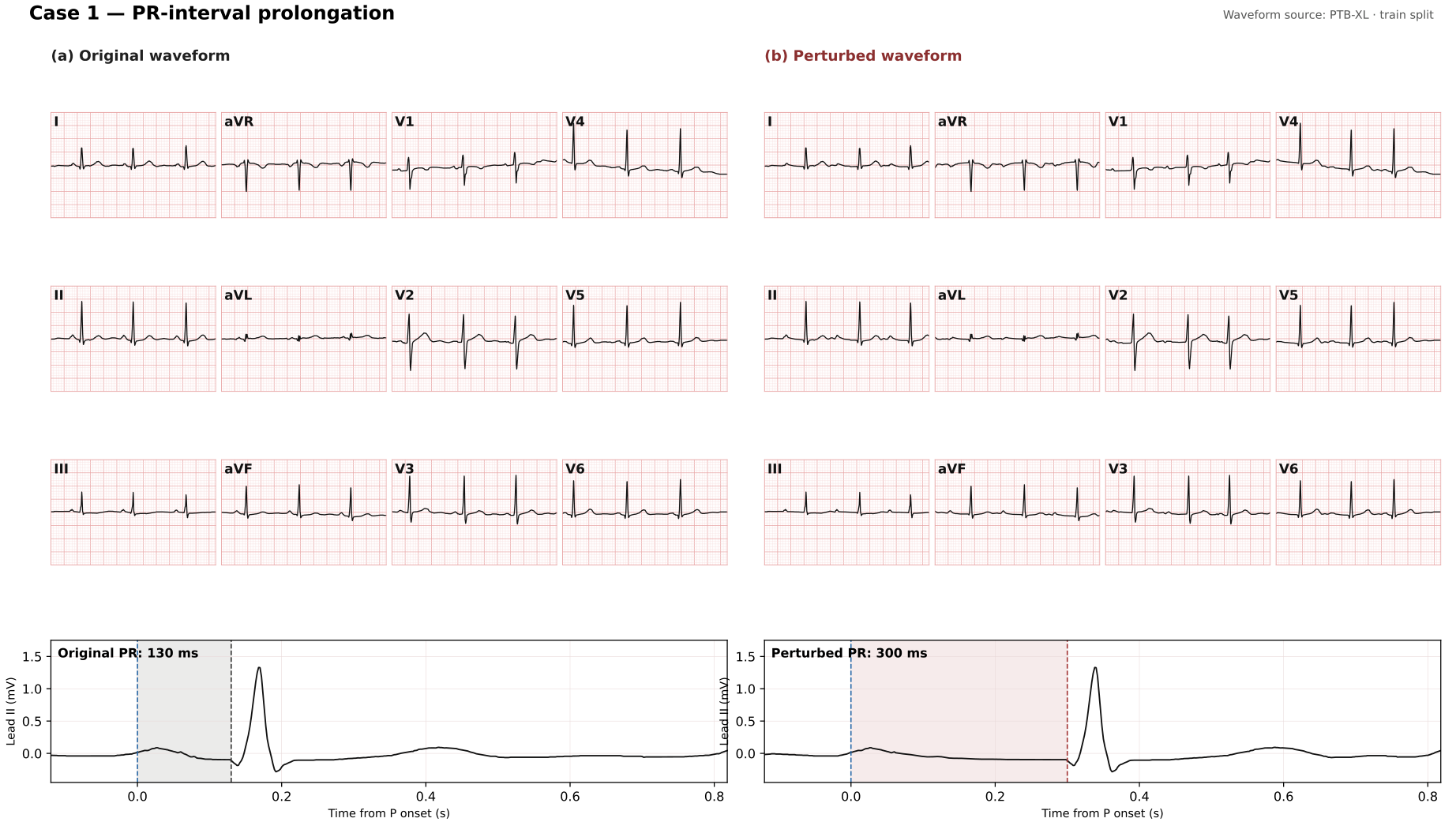 Recorded PR-prolongation example from the paper